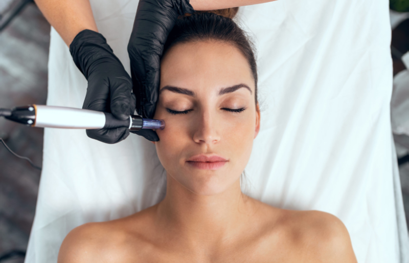 microneedling in fairbanks us | Services