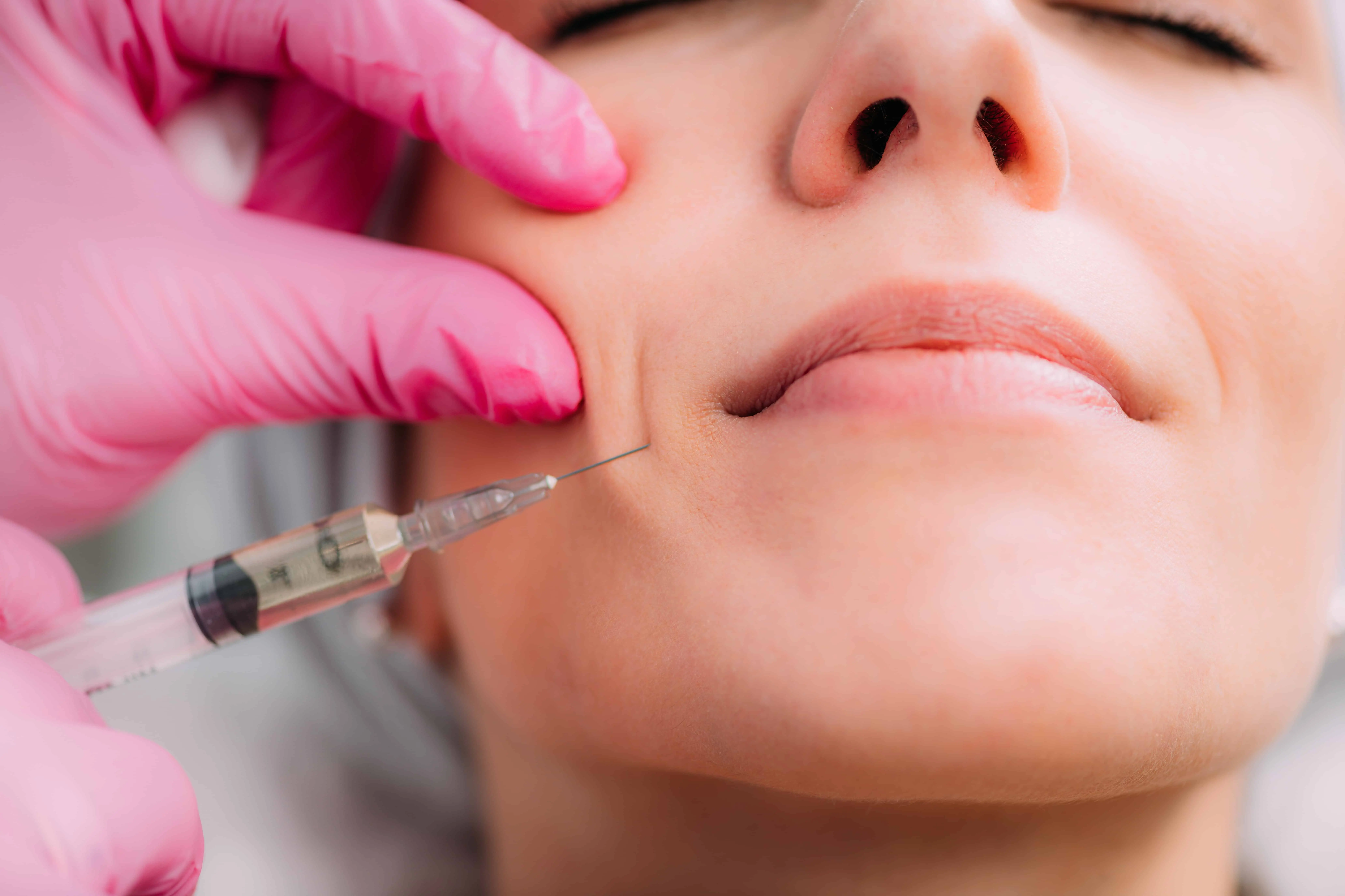 Blog 2 Dermal Fillers by Minnie Street Aesthetics in Fairbanks, AK